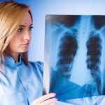 Туберкулез – первые признаки, симптомы, причины, лечение и профилактика туберкулеза