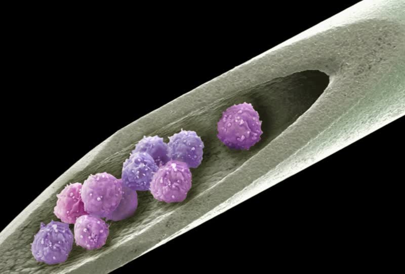Швейцарские ученые показали, как вырастить суставный хрящ из стволовых клеток