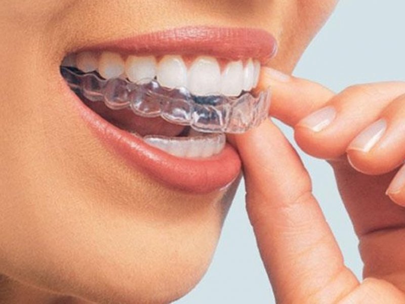 Мифы о зубах