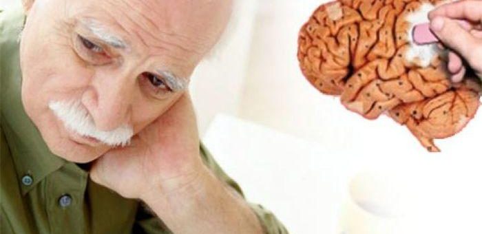 Болезнь Альцгеймера: исследователи создают модель для прогнозирования снижения
