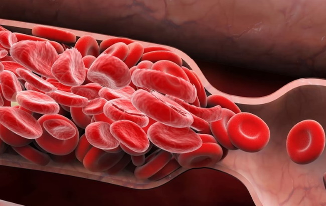 Избыток жира в крови может привести к повреждению органов