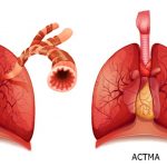Каковы признаки того, что у вас может быть астма?