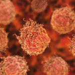 Определен тип опухолевых клеток, который делает рак простаты более агрессивным
