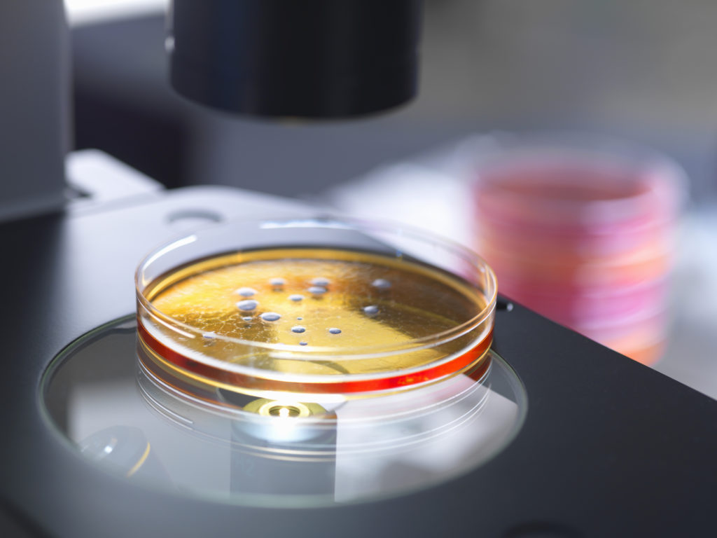 COVID-19: Могут ли быть вовлечены кишечные бактерии?