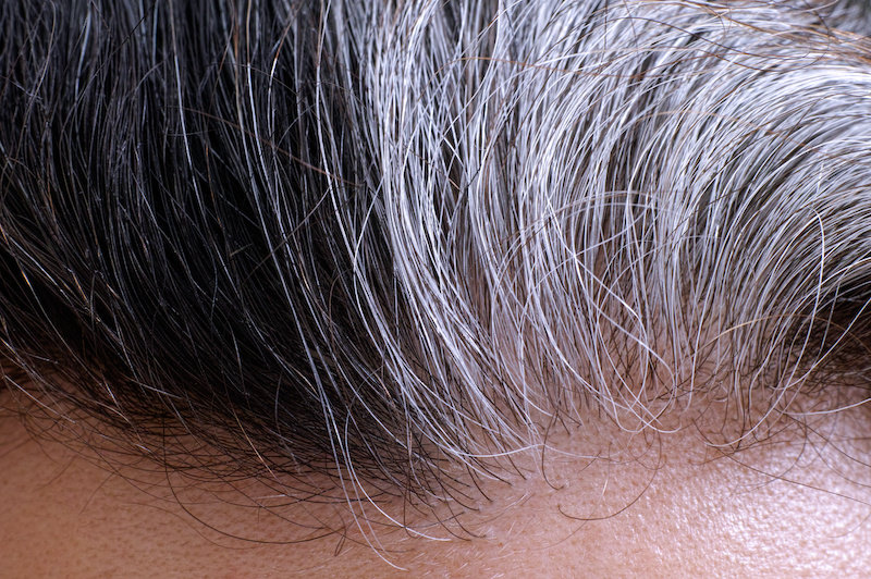 Стресс может сделать волосы седыми - и это обратимо, как выяснили исследователи